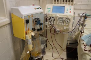 Kauno klinikose pradėta taikyti dviguba plazmos filtracija